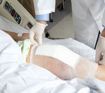 Diz protezi ameliyatı başarı oranları