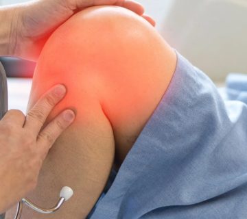 استئوکندریت
