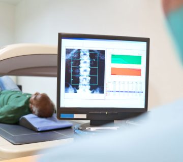 سنجش تراکم استخوان (DEXA)