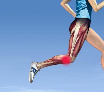 سندرم ایلیوتیبیال باند (ITBS)