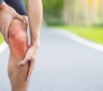 سندروم پاتلوفمورال