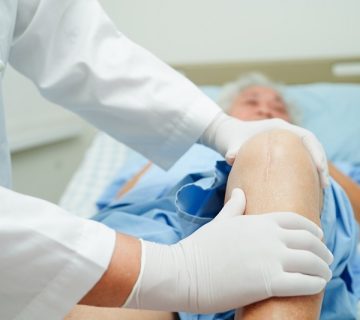 فیزیوتراپی بعد از جراحی تعویض مفصل زانو