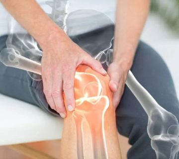 لنگیدن بعد از عمل استئوتومی