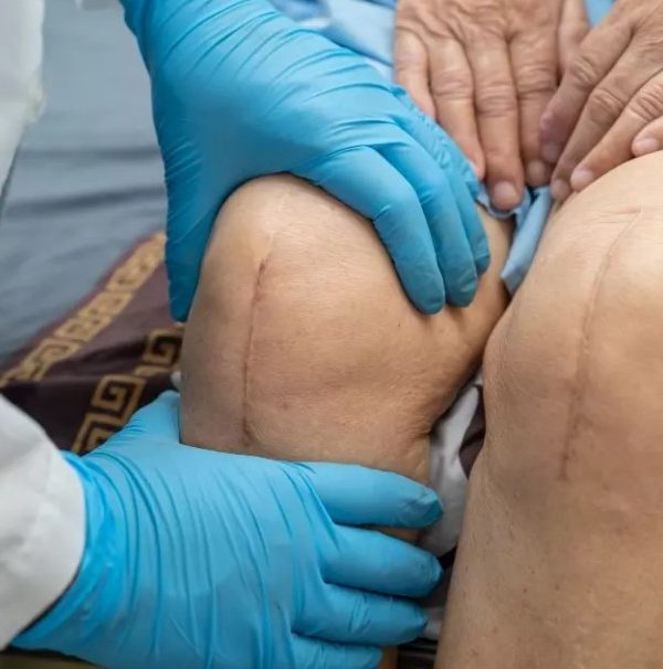 تاثیر اضافه وزن بر جراحی زانو