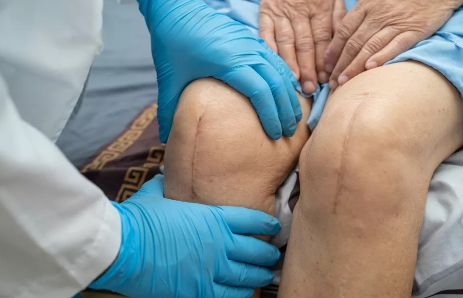 تاثیر اضافه وزن بر جراحی زانو