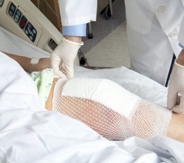 جراحی تعویض مفصل کامل و جزئی