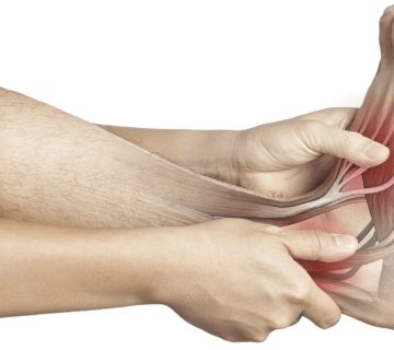 شکستگی استرسی کف پا