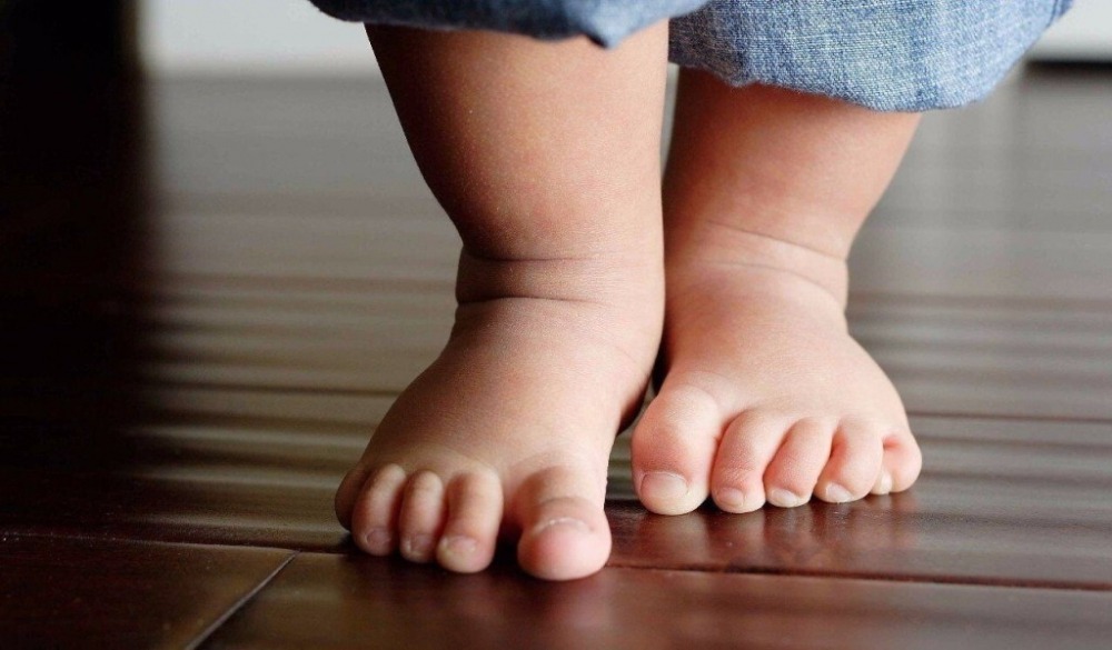 بیماری لگ کالو پرتس