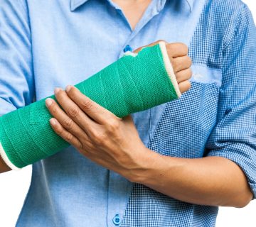 جوش خوردن استخوان